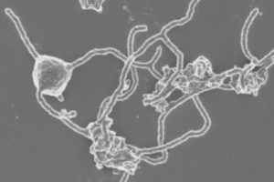 科学家培育出“阿斯加德”古菌 有助解释生命起源缩略图