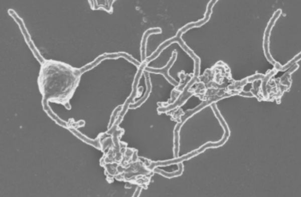 科学家培育出“阿斯加德”古菌 有助解释生命起源