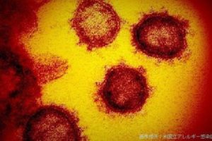 日本国内确诊新冠肺炎809例 死亡25例缩略图