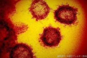 日本国内确诊新冠肺炎1403例 死亡47人缩略图
