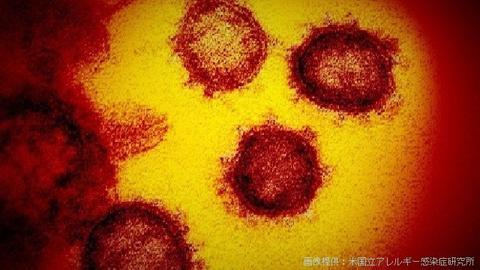 日本国内确诊新冠肺炎1403例 死亡47人