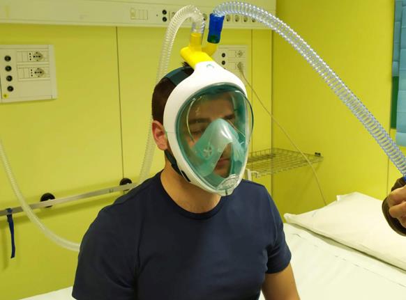 意大利医疗器械短缺 工程师把浮潜面罩改造成呼吸机